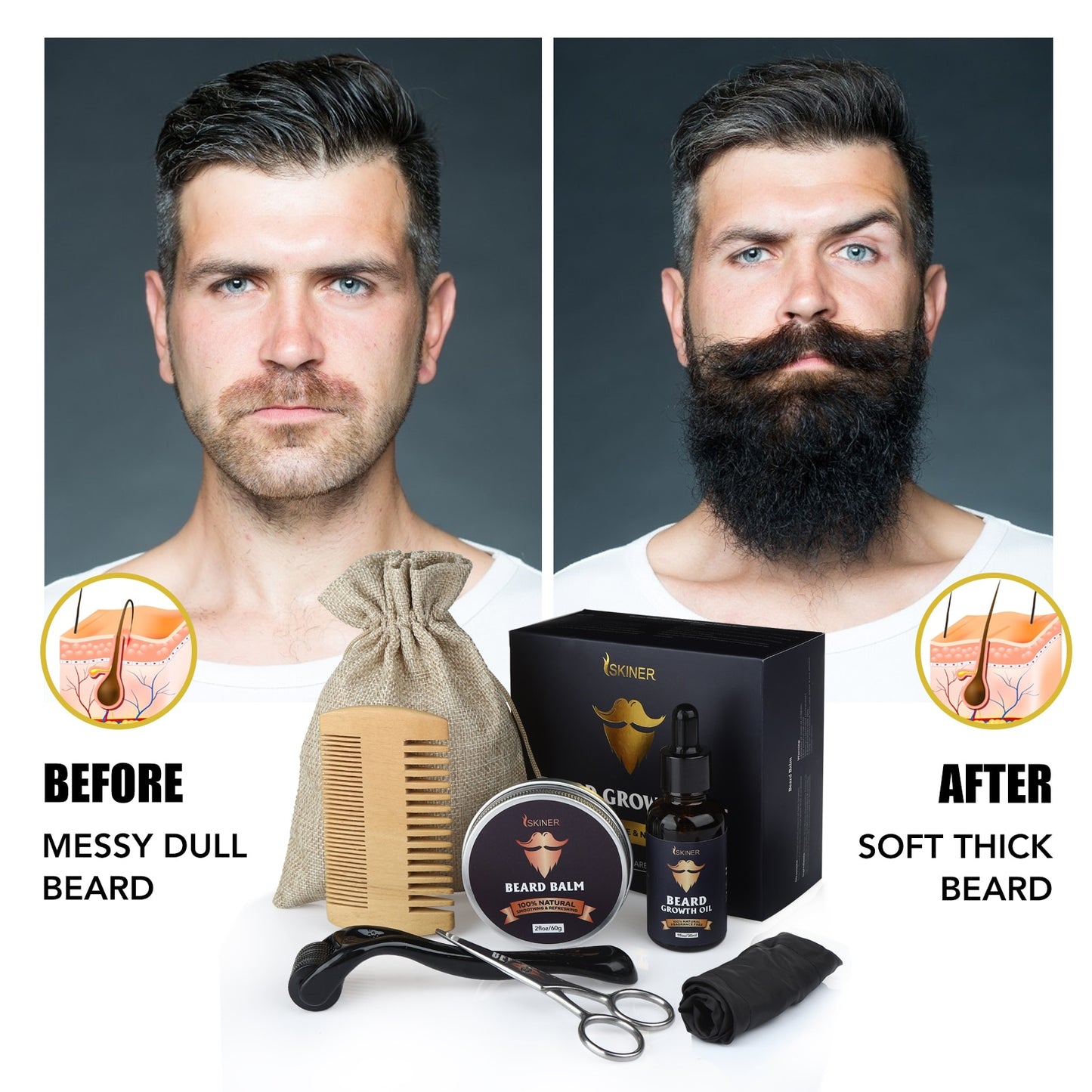 5Pcs/Set Men's Beard Growth Kit Enhancer