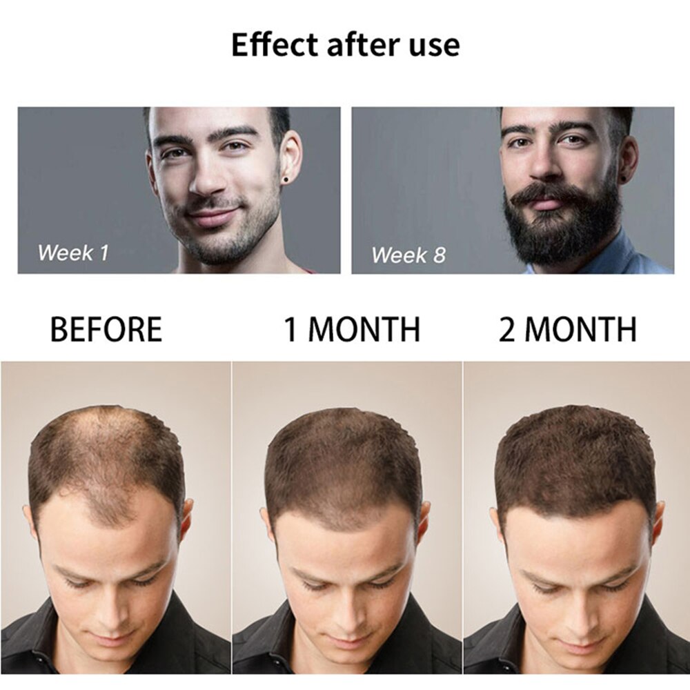 Beard Growth Kit Men's Hair Growth